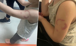 3 yaşındaki çocuğu ısırdığı iddia edildi, bakıcı tutuklandı!