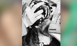 Amedspor–Bodrumspor maçı öncesi olay: Kadın taraftar yaralandı