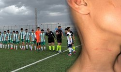 Diyarbakır temsilcisi U14 takımının maçında kavga: Genç sporcular hedef oldu