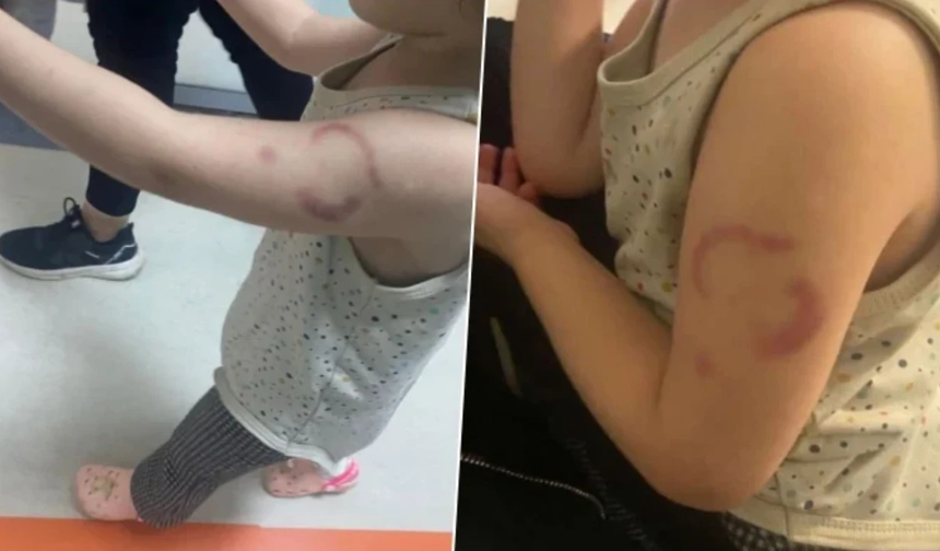 3 yaşındaki çocuğu ısırdığı iddia edildi, bakıcı tutuklandı!