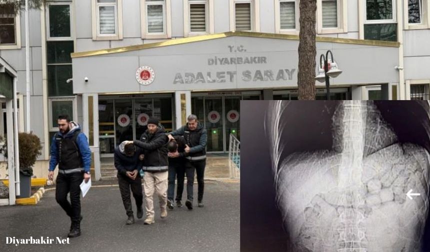 Diyarbakır'da 'Yok artık' dedirten operasyon: Yasaklı maddeyi öyle bir yerlerinde sakladılar ki!